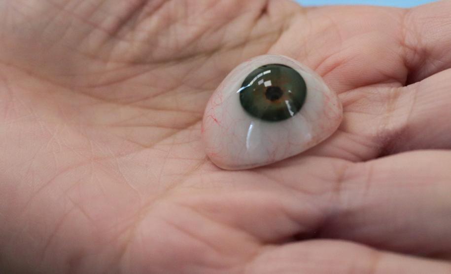 HR produz pelo SUS próteses faciais que recuperam autoestima dos pacientes