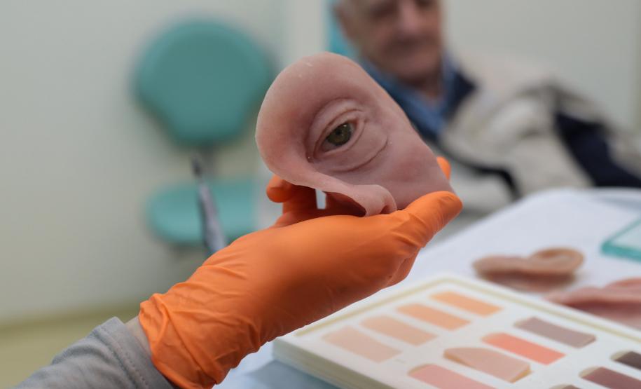 HR produz pelo SUS próteses faciais que recuperam autoestima dos pacientes