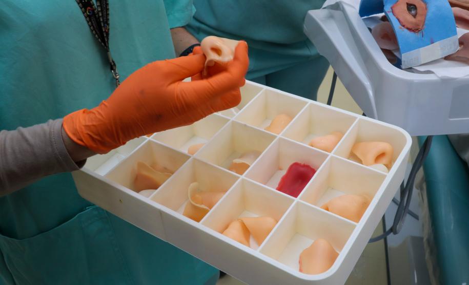 HR produz pelo SUS próteses faciais que recuperam autoestima dos pacientes