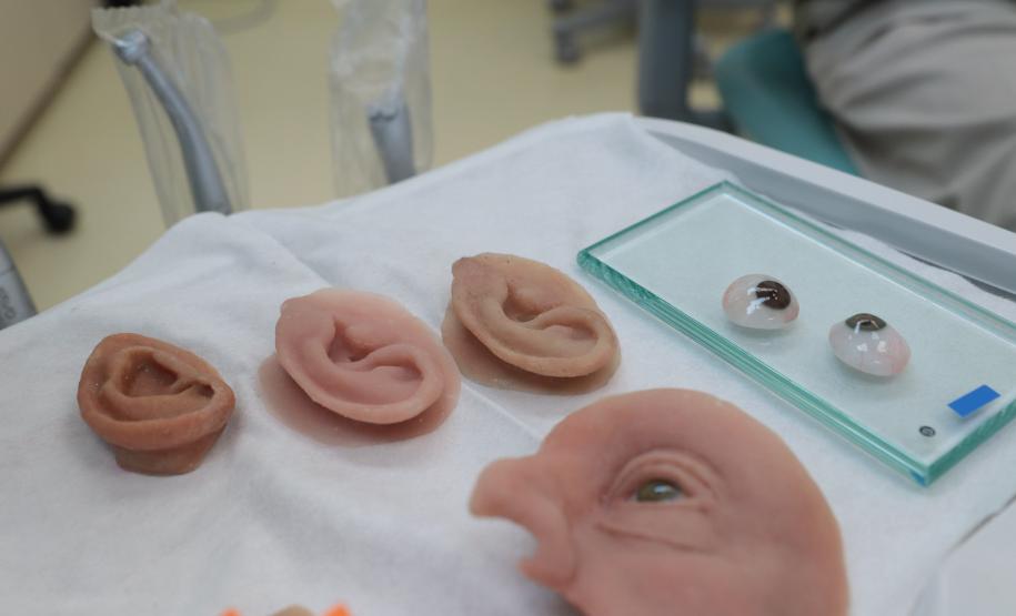 HR produz pelo SUS próteses faciais que recuperam autoestima dos pacientes