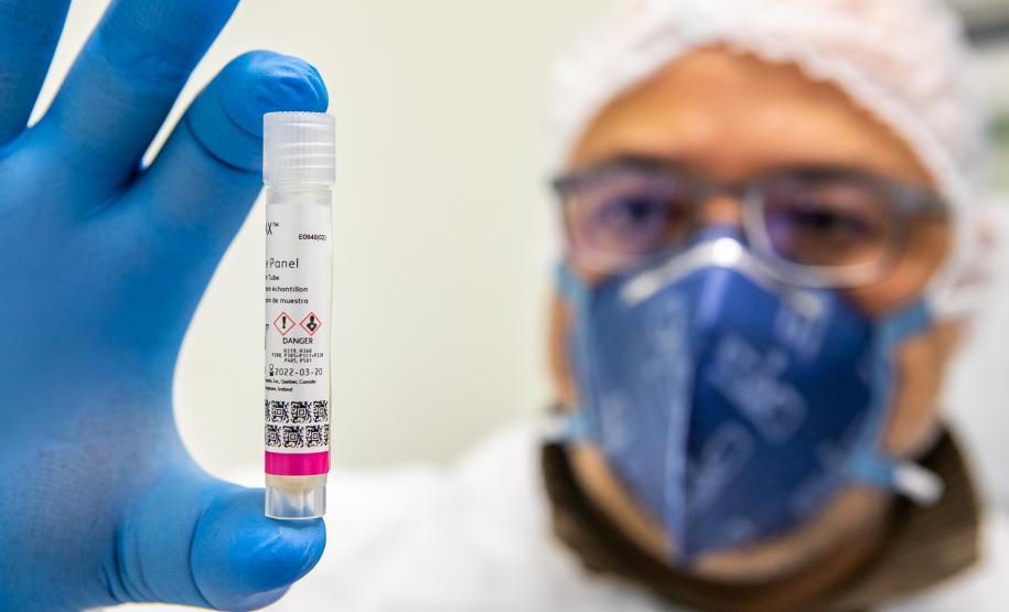 Em seis meses, Lacen processa 13.298 amostras de vírus respiratórios