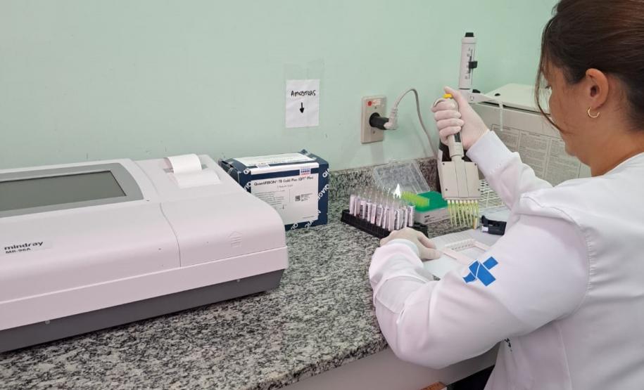 Controle da tuberculose avança no Paraná com aumento de 43% no tratamento preventivo