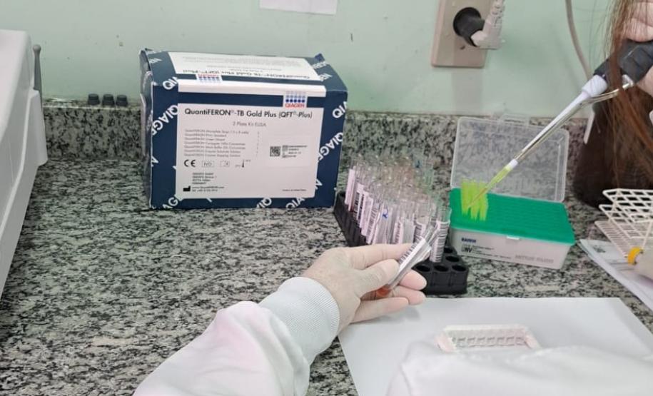 Controle da tuberculose avança no Paraná com aumento de 43% no tratamento preventivo