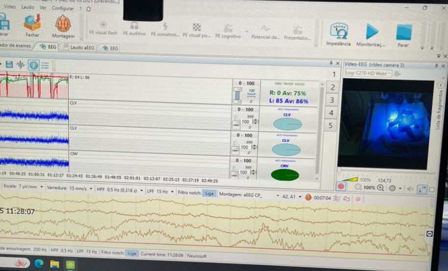 Hospital Regional do Sudoeste inicia testes da UTI Neonatal Neurológica, pioneira na rede
