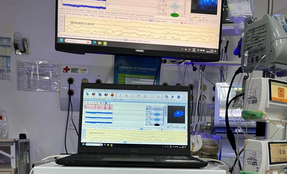 Hospital Regional do Sudoeste inicia testes da UTI Neonatal Neurológica, pioneira na rede