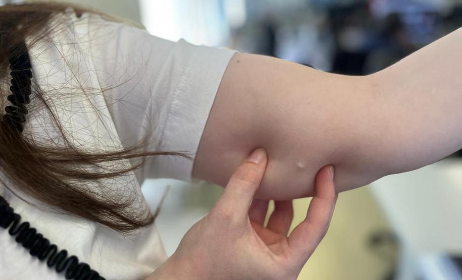 Implante contraceptivo de até R$ 4 mil chega gratuitamente ao SUS no Paraná