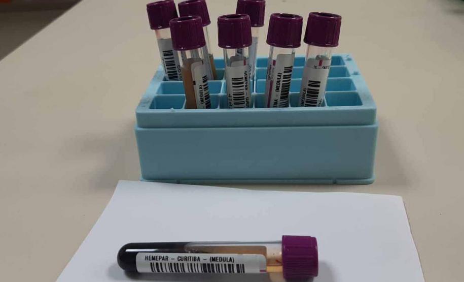 Fevereiro Laranja: mês da conscientização sobre leucemia reforça importância do diagnóstico