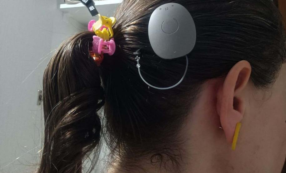 Paraná assume liderança nacional em implantes de correção auditiva pelo SUS