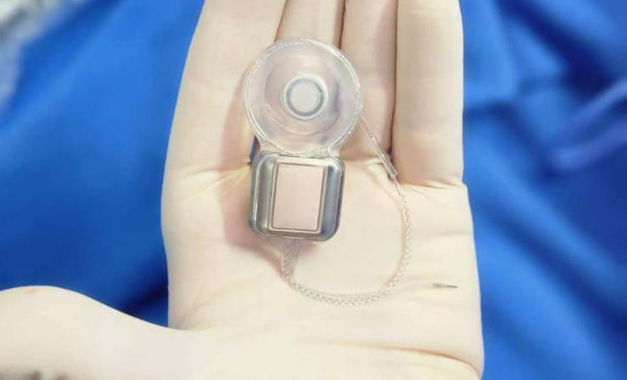 Paraná assume liderança nacional em implantes de correção auditiva pelo SUS