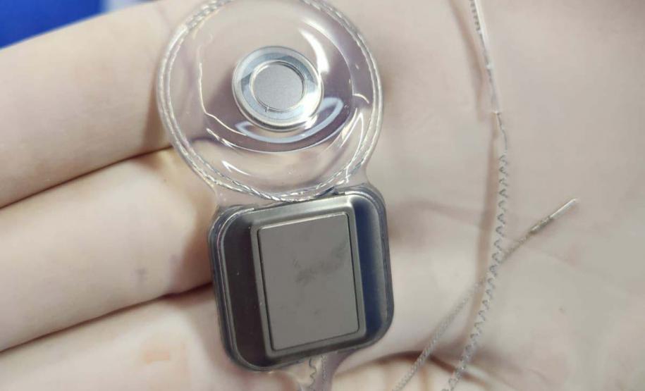 Paraná assume liderança nacional em implantes de correção auditiva pelo SUS