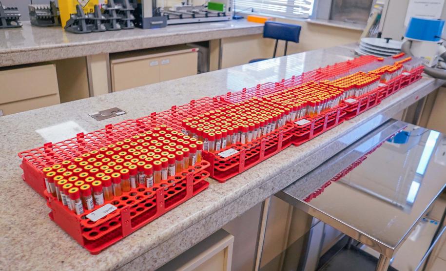 Hemepar passa a fazer testes sorológicos para aumentar segurança em transplantes