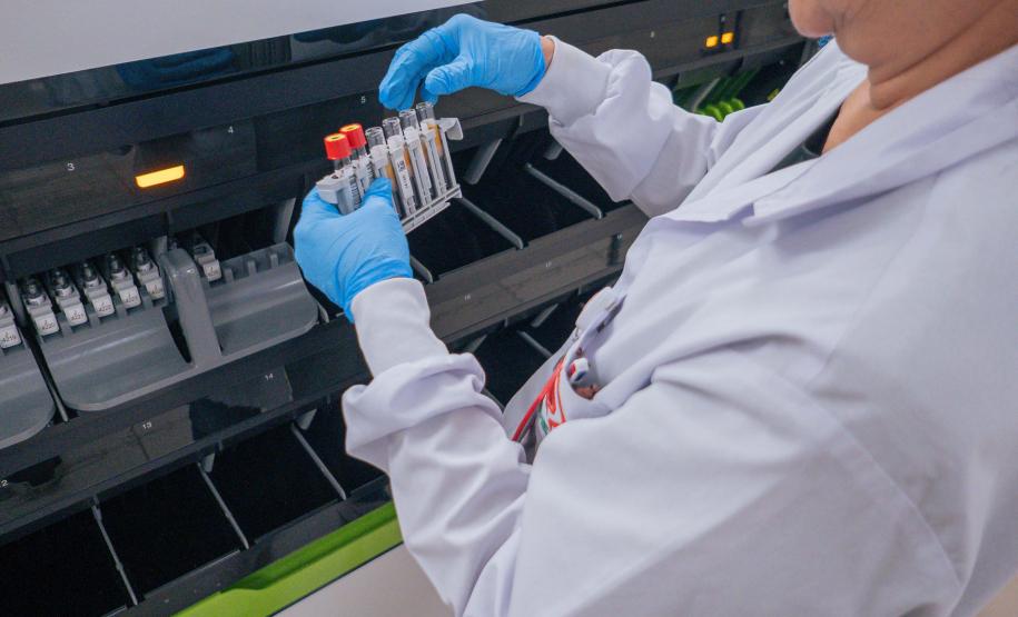 Hemepar passa a fazer testes sorológicos para aumentar segurança em transplantes