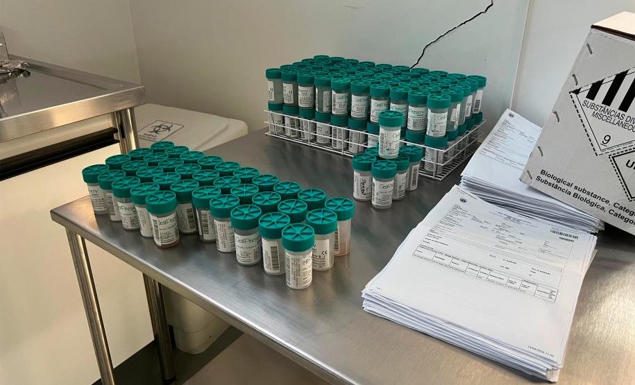 Paraná reduz tempo do diagnóstico de febre amarela em primatas e agiliza vigilância