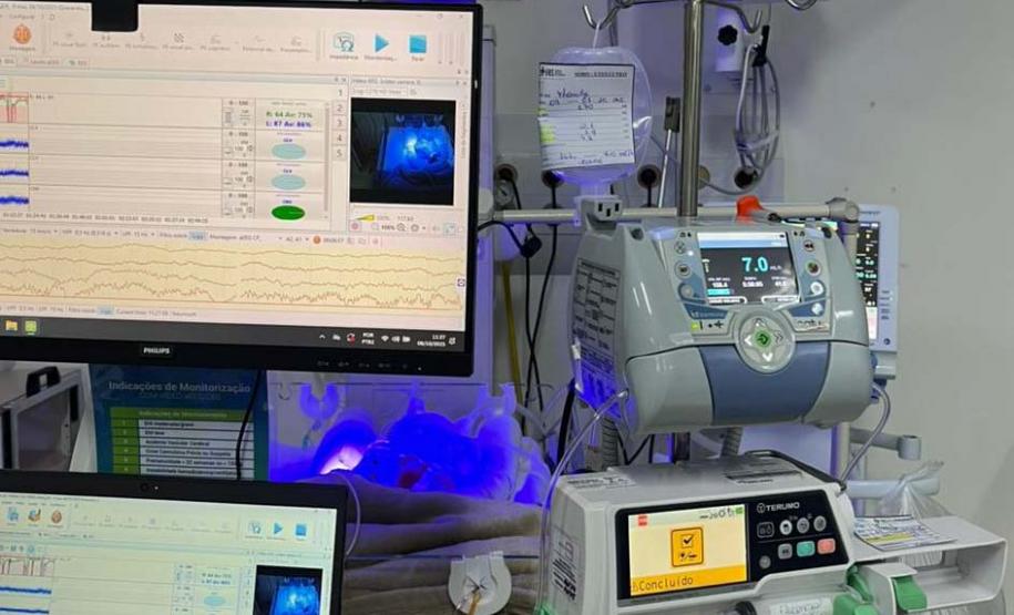 Hospitais públicos do Estado implantam primeiras unidades de UTI Neonatal Neurológica