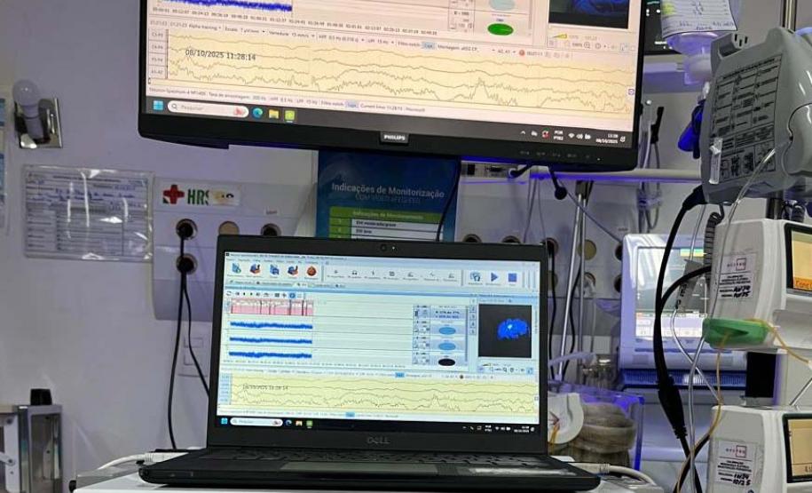 Hospitais públicos do Estado implantam primeiras unidades de UTI Neonatal Neurológica