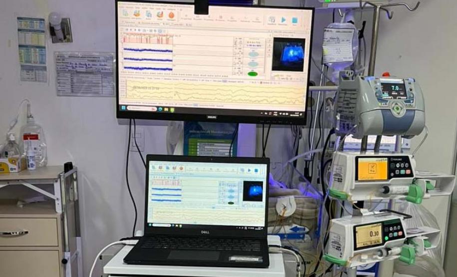 Hospitais públicos do Estado implantam primeiras unidades de UTI Neonatal Neurológica