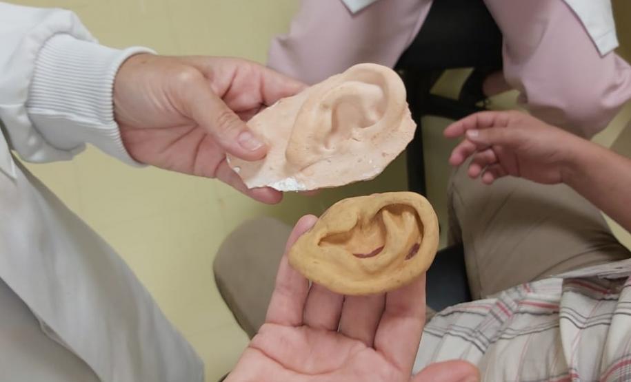 Ambulatório de Próteses Faciais Reconstrutivas inicia atendimentos pelo Sus