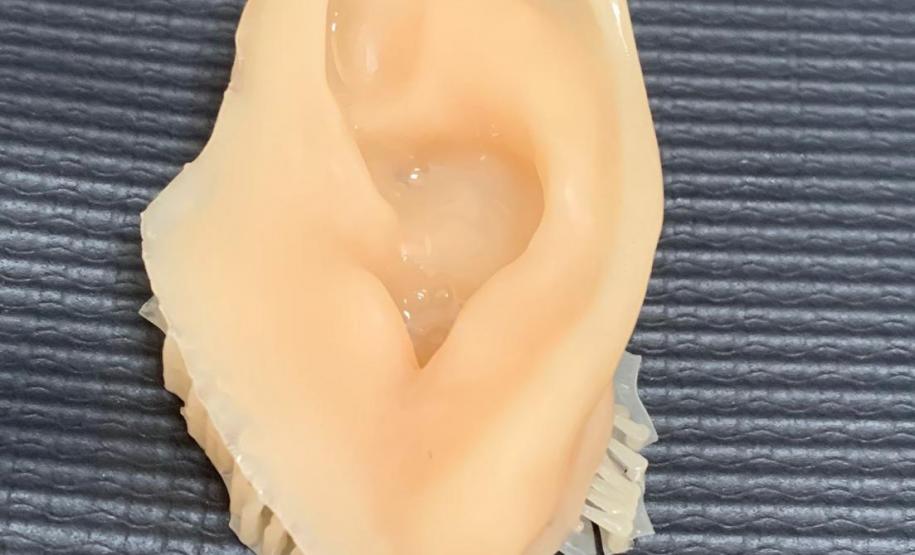 Ambulatório de Próteses Faciais Reconstrutivas inicia atendimentos pelo Sus