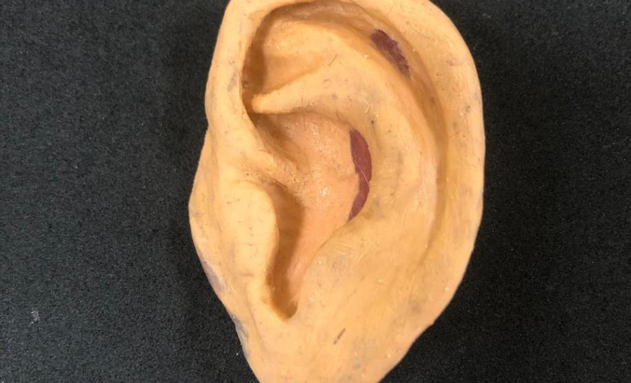 Ambulatório de Próteses Faciais Reconstrutivas inicia atendimentos pelo Sus