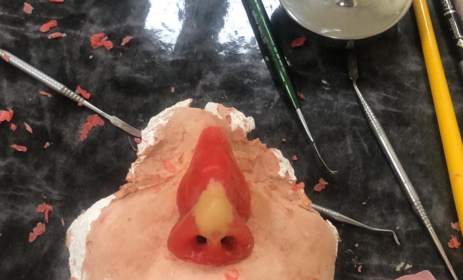 Ambulatório de Próteses Faciais Reconstrutivas inicia atendimentos pelo Sus