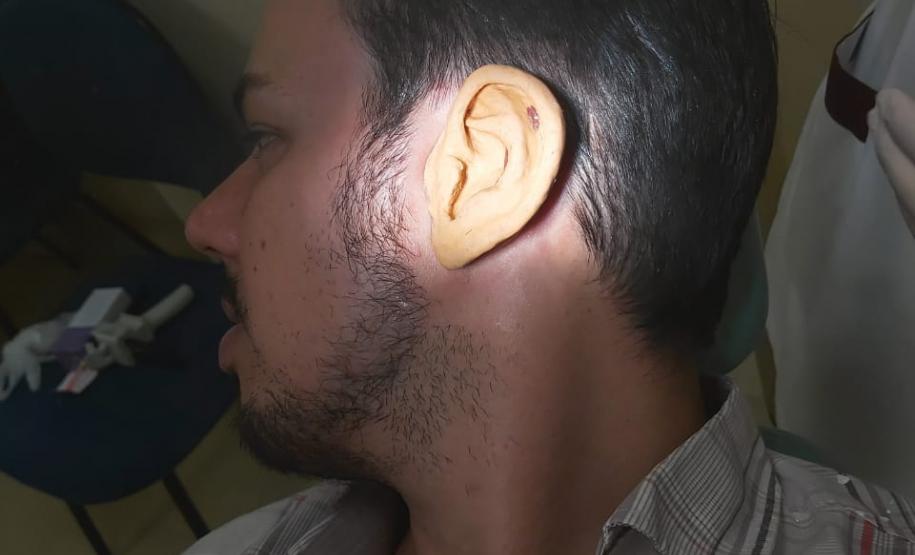 Ambulatório de Próteses Faciais Reconstrutivas inicia atendimentos pelo Sus