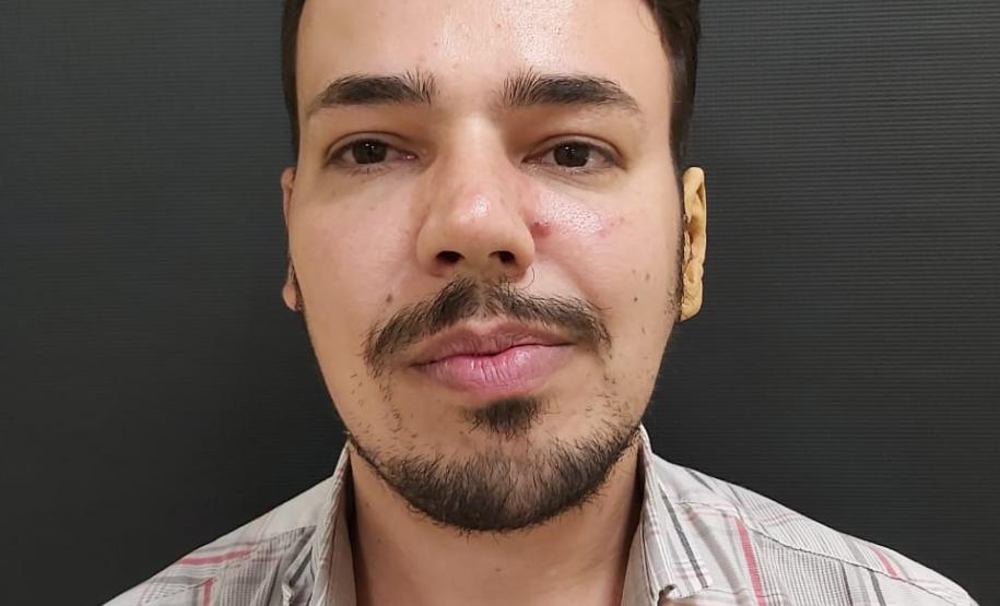 Ambulatório de Próteses Faciais Reconstrutivas inicia atendimentos pelo Sus