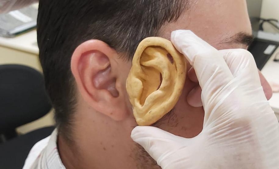 Ambulatório de Próteses Faciais Reconstrutivas inicia atendimentos pelo Sus