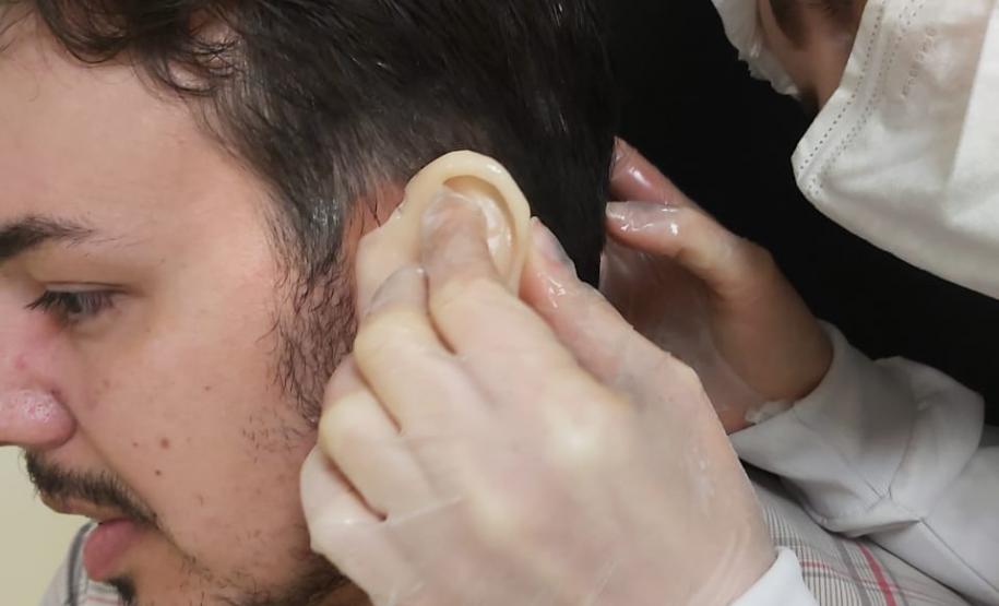 Ambulatório de Próteses Faciais Reconstrutivas inicia atendimentos pelo Sus