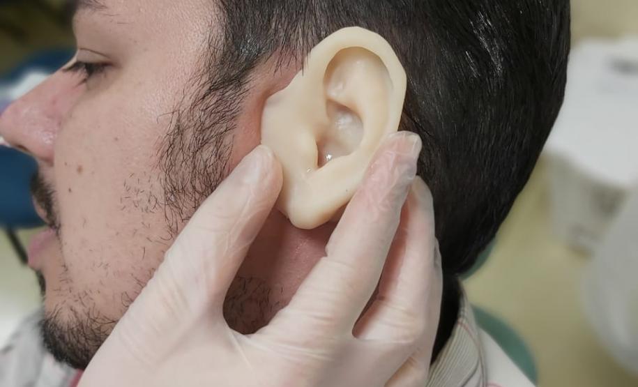 Ambulatório de Próteses Faciais Reconstrutivas inicia atendimentos pelo Sus