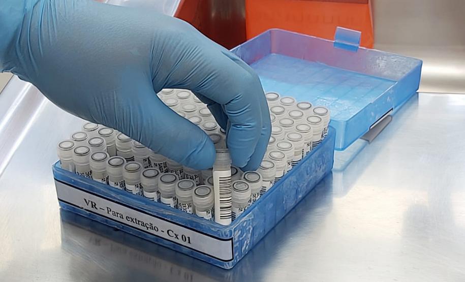 Saiba como é feito o exame para detectar o novo coronavírus