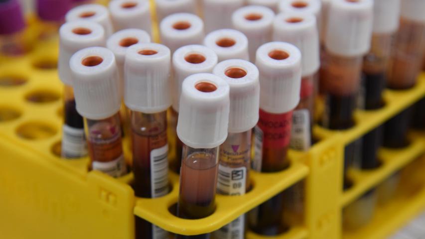 Junho Vermelho: Secretaria de Saúde reforça importância da doação de sangue