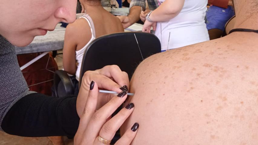 Paraná forma médicos da Atenção Primária para atuar com acupuntura no SUS