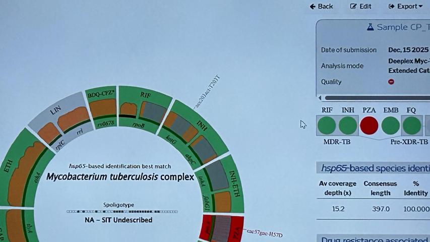 O Deeplex é um sistema de sequenciamento de nova geração, que antes era aplicado apenas em pesquisas e agora está disponível para diagnóstico. O sistema custa mais de R$ 270 mil para utilização anual.